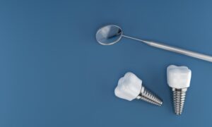 Stomatološka ordinacija Beograd - Art Dental House